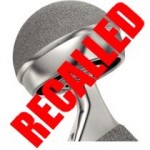 defective products depuy hip implants