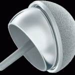 depuy hip implant recall attorneys in nj and pa