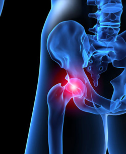 depuy hip recall lawyers in new jersey and philadelphia