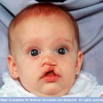 birth defects attorneys in nj and pa